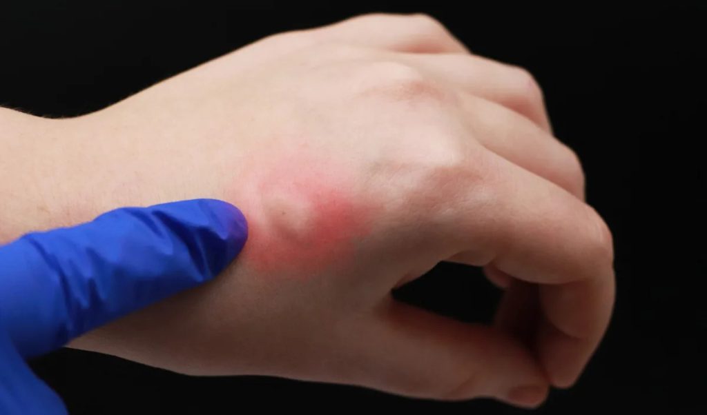 This is an image uploaded via the WordPress REST API.